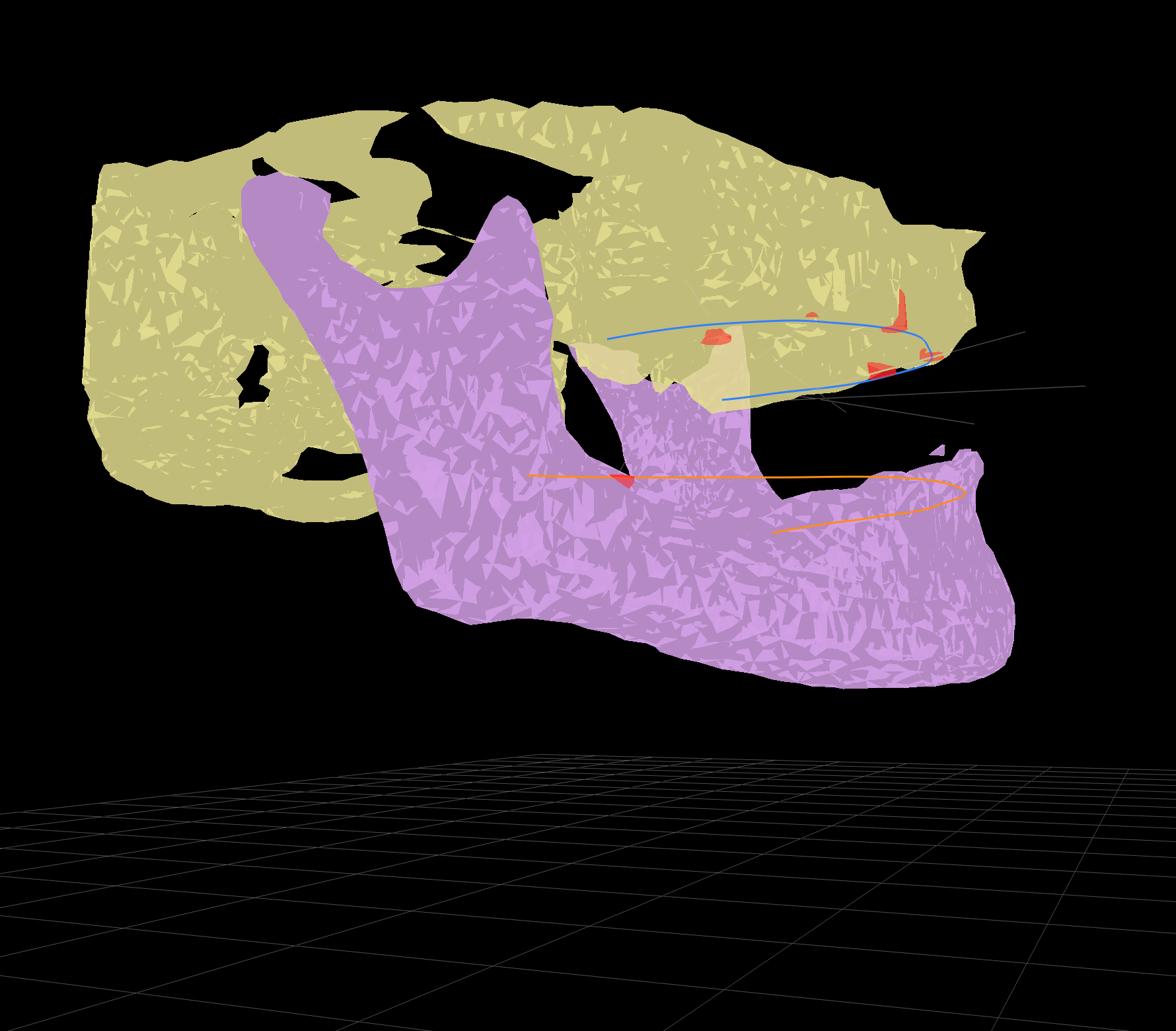 AI segmentation result