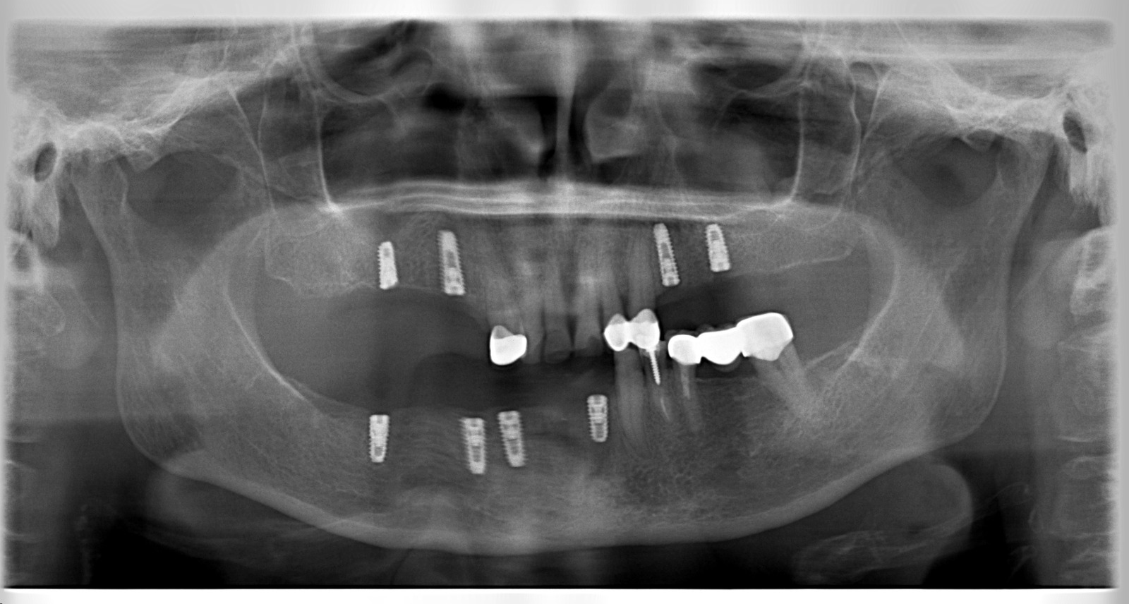 CBCT upload screen